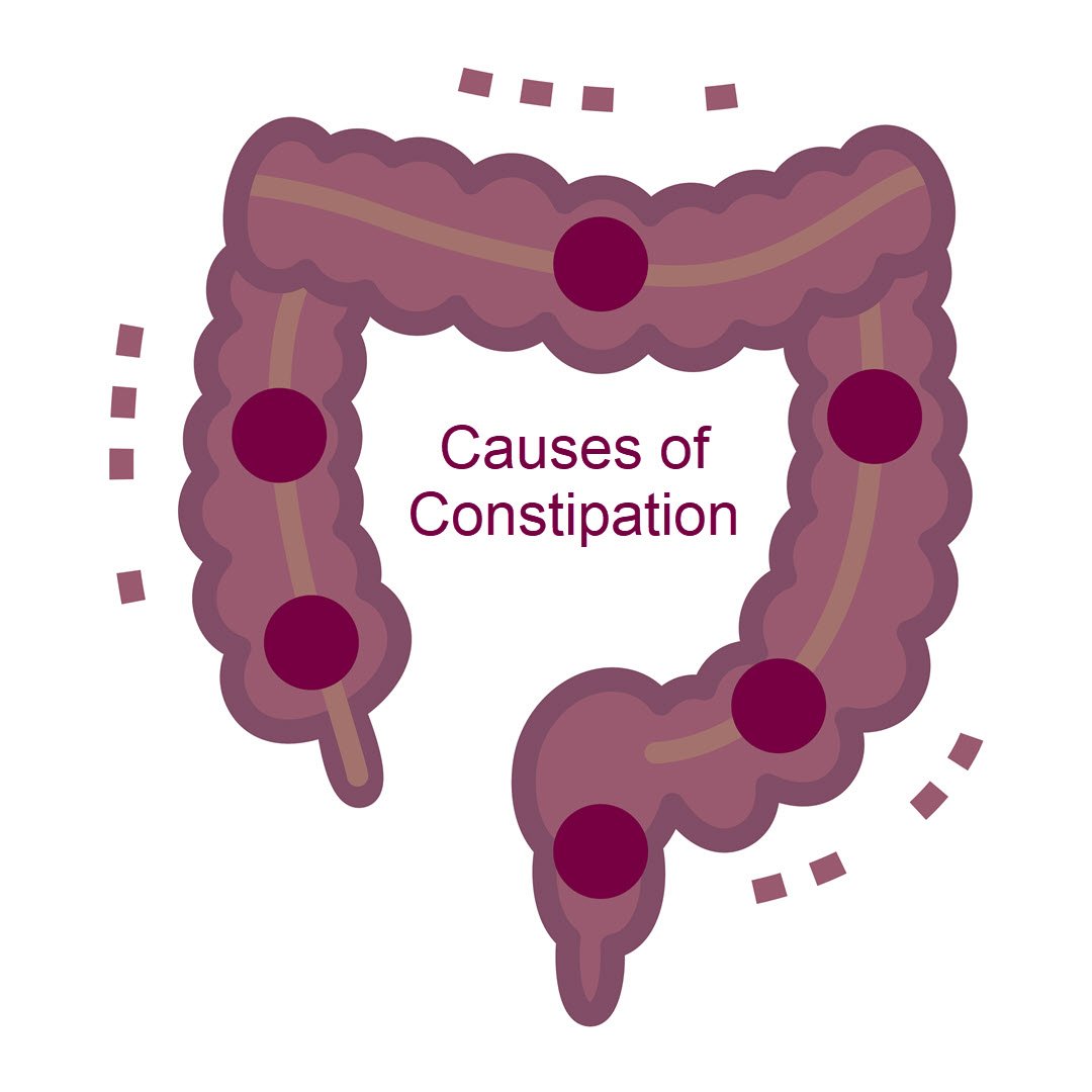 Causes of Constipation