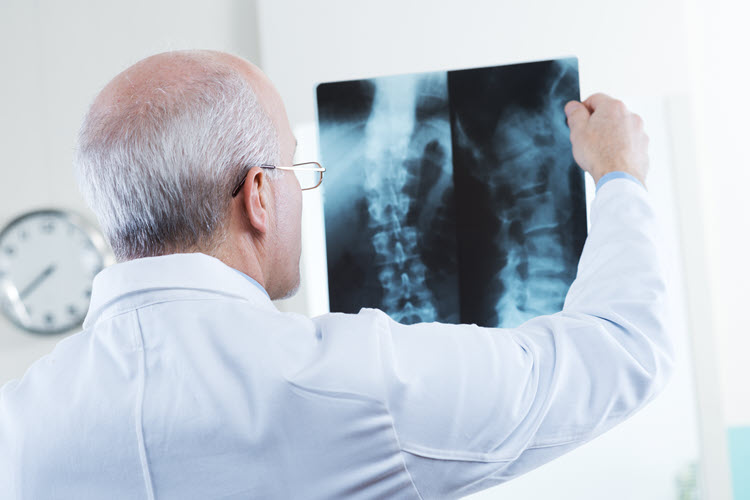 Educational Awareness – Spinal Problems